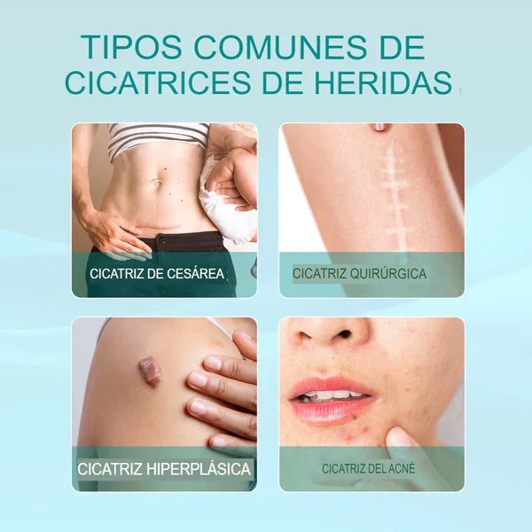Scar Remove® - El más vendido de USA