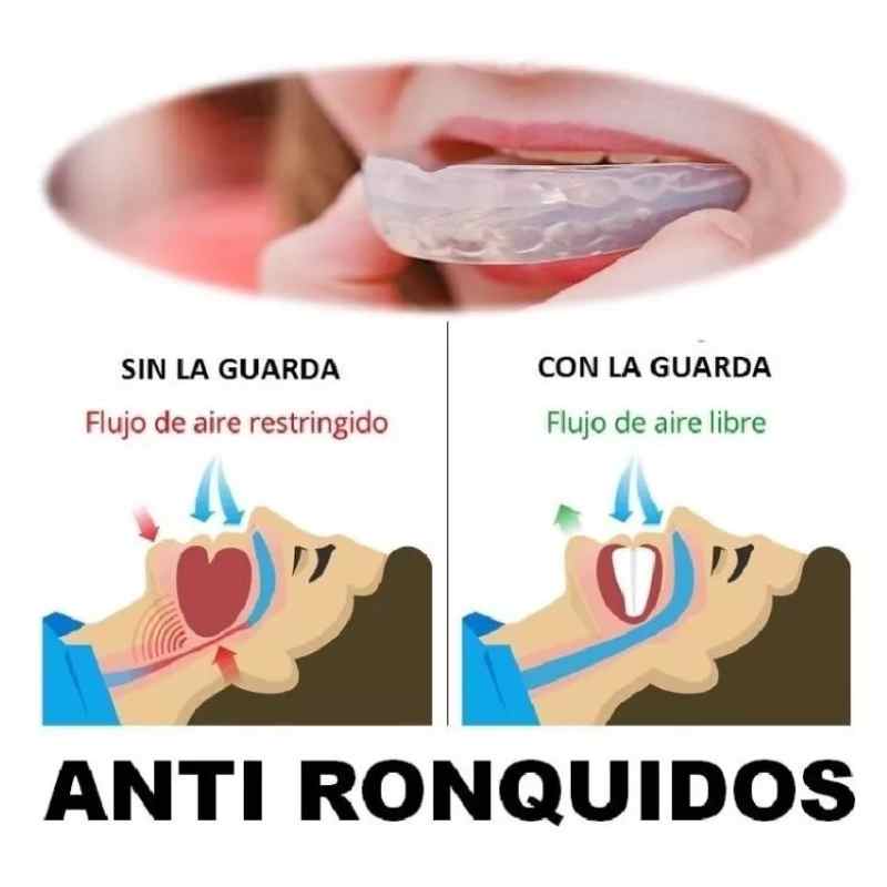 RoncaStop™ Anti ronquidos y bruxismo paga 1 lleva 2 remate de inventario