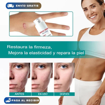 Scar Remove® - El más vendido de USA